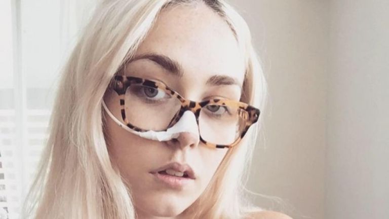 Claudia Powell rikta betegsége miatt nem képes állni