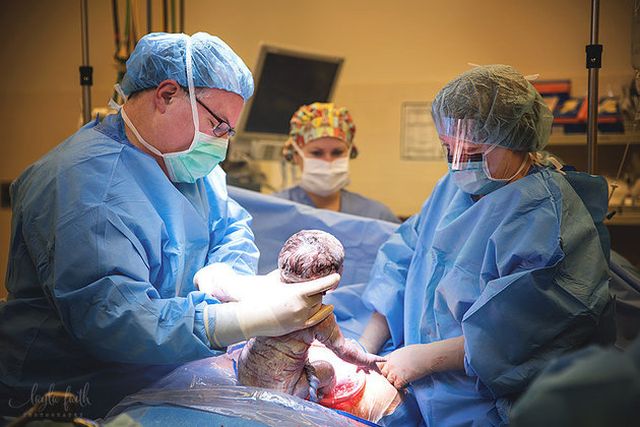 A császármetszés is lehet gyönyörű szülésélmény - megható fotók A császármetszés is lehet gyönyörű szülésélmény - megható fotók