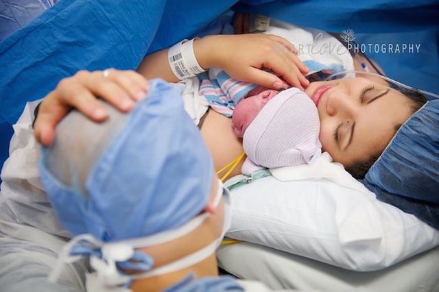 A császármetszés is lehet gyönyörű szülésélmény - megható fotók A császármetszés is lehet gyönyörű szülésélmény - megható fotók