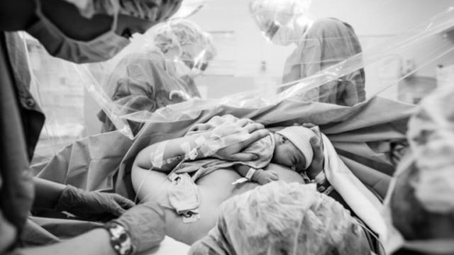 A császármetszés is lehet gyönyörű szülésélmény - megható fotók A császármetszés is lehet gyönyörű szülésélmény - megható fotók