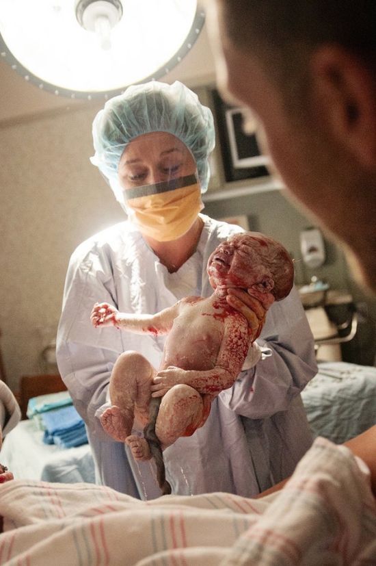 A császármetszés is lehet gyönyörű szülésélmény - megható fotók A császármetszés is lehet gyönyörű szülésélmény - megható fotók