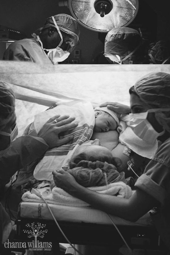 A császármetszés is lehet gyönyörű szülésélmény - megható fotók A császármetszés is lehet gyönyörű szülésélmény - megható fotók