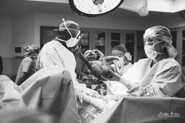 A császármetszés is lehet gyönyörű szülésélmény - megható fotók A császármetszés is lehet gyönyörű szülésélmény - megható fotók