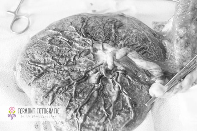 Te betennéd a babád mellé a méhlepényed képét a családi fotóalbumba? - fotók