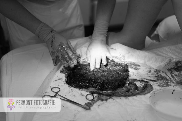 Te betennéd a babád mellé a méhlepényed képét a családi fotóalbumba? - fotók