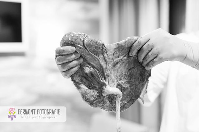 Te betennéd a babád mellé a méhlepényed képét a családi fotóalbumba? - fotók