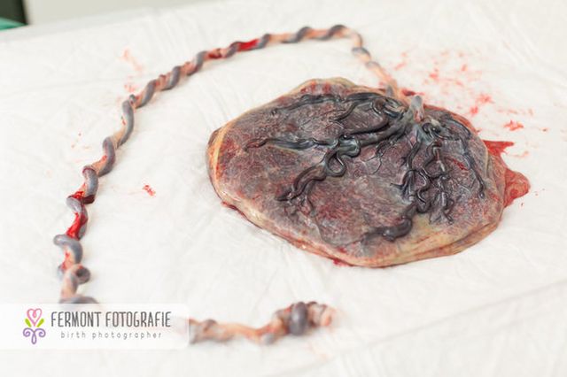 Te betennéd a babád mellé a méhlepényed képét a családi fotóalbumba? - fotók