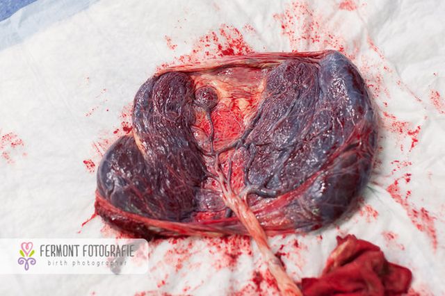 Te betennéd a babád mellé a méhlepényed képét a családi fotóalbumba? - fotók