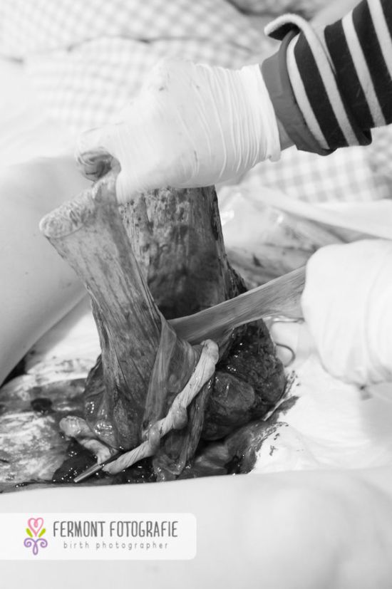 Te betennéd a babád mellé a méhlepényed képét a családi fotóalbumba? - fotók