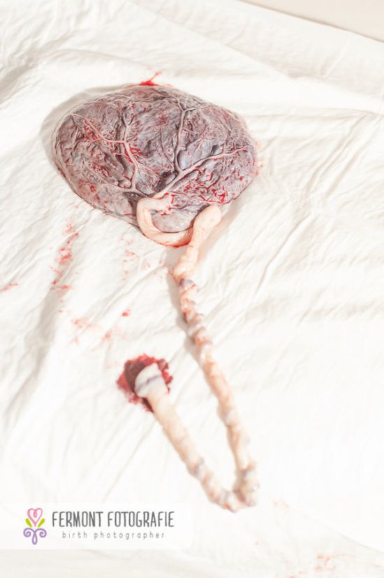 Te betennéd a babád mellé a méhlepényed képét a családi fotóalbumba? - fotók