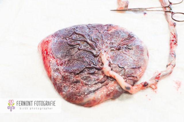 Te betennéd a babád mellé a méhlepényed képét a családi fotóalbumba? - fotók