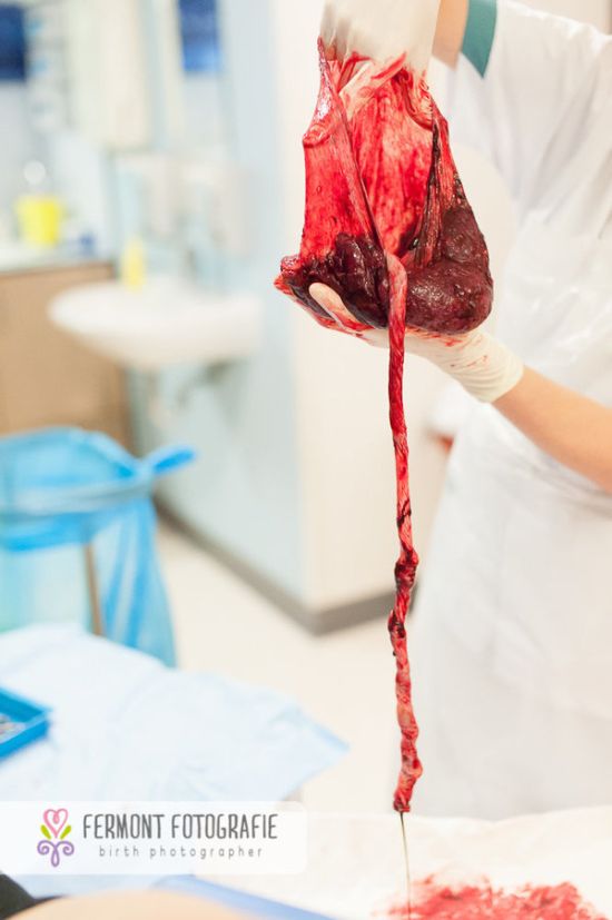 Te betennéd a babád mellé a méhlepényed képét a családi fotóalbumba? - fotók