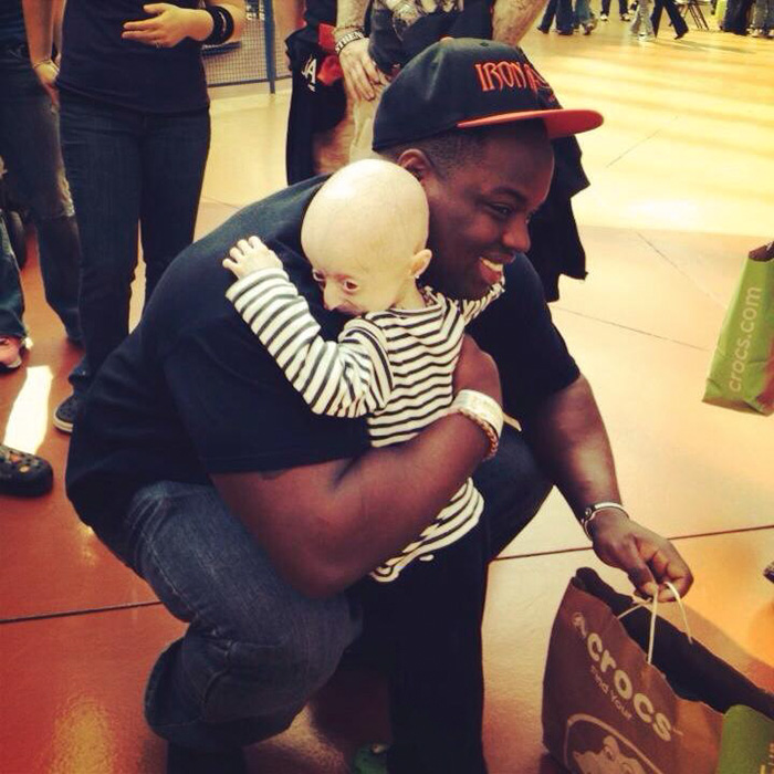 Különös barátra tett szert a ritka betegségben szenvedő kislány Különös barátra tett szert a ritka betegségben szenvedő kislány