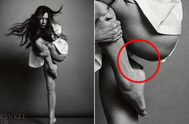 Eltűnt egy darab Victoria Beckham combjából Eltűnt egy darab Victoria Beckham combjából