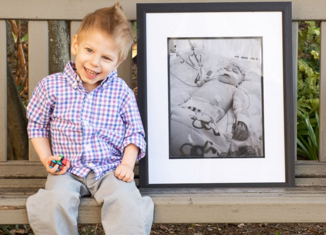 Saját fotóikkal népszerűsítik a szervadományozást az átültetésen átesett gyerekek