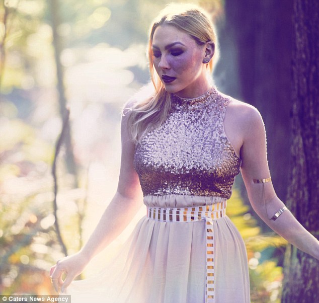 Egész életében bántották bőrhibája miatt a lányt - most arra tanít, hogyan fogadjuk el magunkat