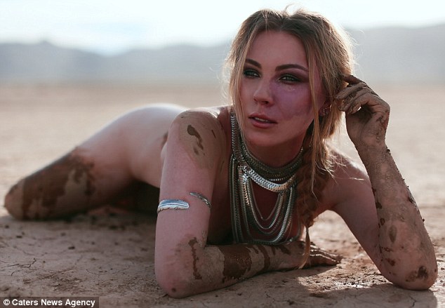 Egész életében bántották bőrhibája miatt a lányt - most arra tanít, hogyan fogadjuk el magunkat