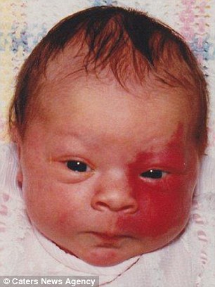 Egész életében bántották bőrhibája miatt a lányt - most arra tanít, hogyan fogadjuk el magunkat