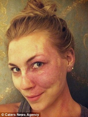 Egész életében bántották bőrhibája miatt a lányt - most arra tanít, hogyan fogadjuk el magunkat