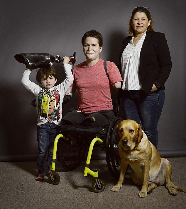 Azt hitte, náthás - végül mind a négy végtagját és az arcát is elveszítette a fiatal apuka