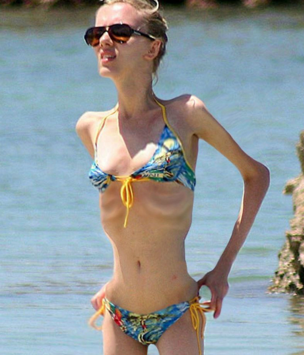 Félelmetes a 40 kilós Jennifer Aniston - nézd meg a csontsovány sztárokat Félelmetes a 40 kilós Jennifer Aniston - nézd meg a csontsovány sztárokat