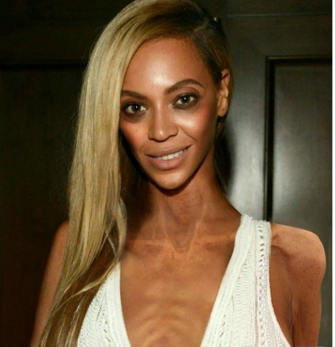 Félelmetes a 40 kilós Jennifer Aniston - nézd meg a csontsovány sztárokat Félelmetes a 40 kilós Jennifer Aniston - nézd meg a csontsovány sztárokat