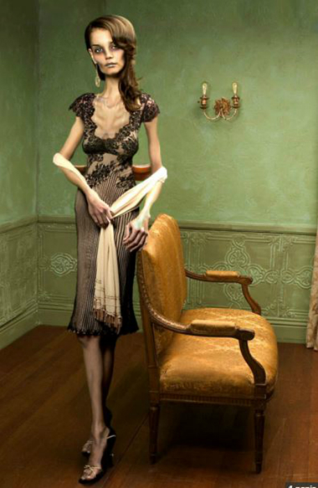 Félelmetes a 40 kilós Jennifer Aniston - nézd meg a csontsovány sztárokat Félelmetes a 40 kilós Jennifer Aniston - nézd meg a csontsovány sztárokat