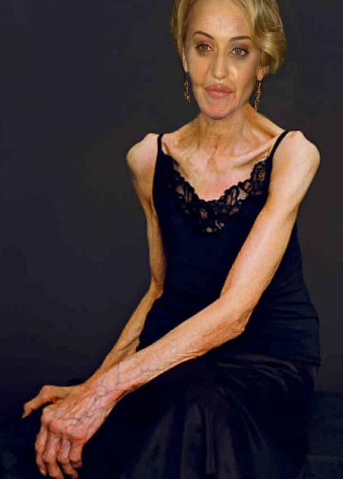 Félelmetes a 40 kilós Jennifer Aniston - nézd meg a csontsovány sztárokat Félelmetes a 40 kilós Jennifer Aniston - nézd meg a csontsovány sztárokat