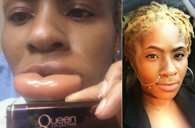 Gigantikusra duzzadt az ajka a rúzstól - fotó