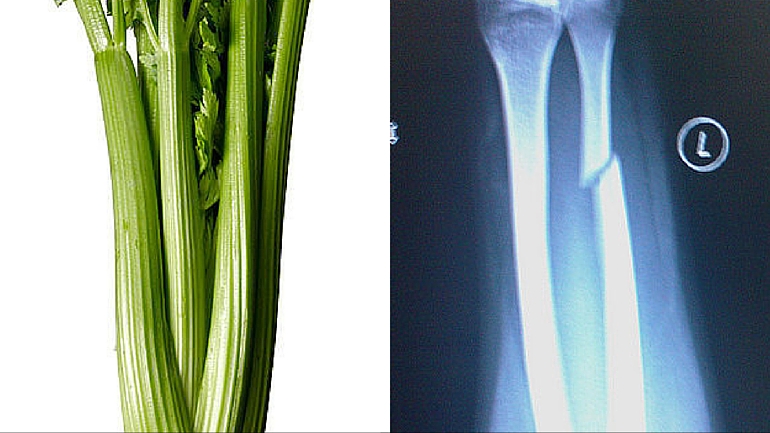 Ezekkel a képekkel egy életre megjegyzed, mire jók az egyes ételek