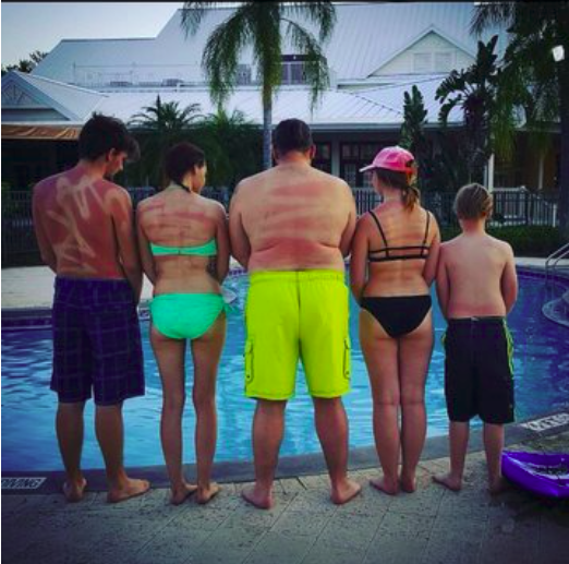 Ez történik, ha csak úgy magadra spricceled a naptejet