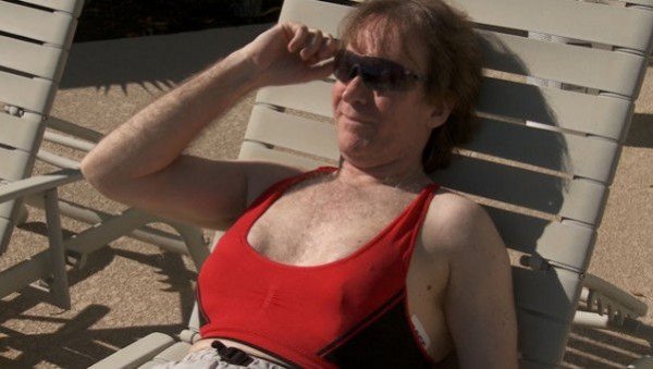 Fogadásból rakatott be magának mellimplantátumokat egy férfi - 20 év után most megvált tőlük Fogadásból rakatott be magának mellimplantátumokat egy férfi - 20 év után most megvált tőlük