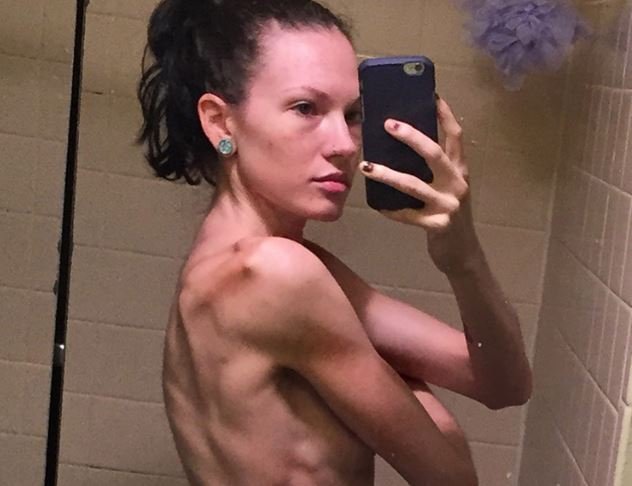 Rákosnak hitték a 27 éves lányt – ez mentette meg az életét 