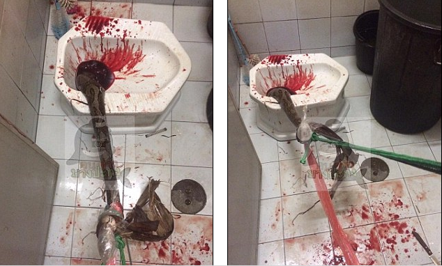 Óriási piton harapta péniszen, miközben a vécén ült - sokkoló fotók Óriási piton harapta péniszen, miközben a vécén ült - sokkoló fotók