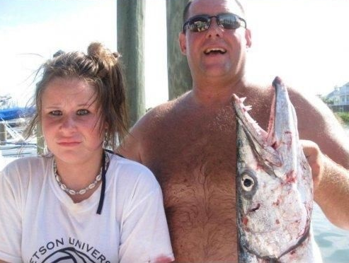 Halszörny harapdálta össze a 14 éves lány karját Halszörny harapdálta össze a 14 éves lány karját