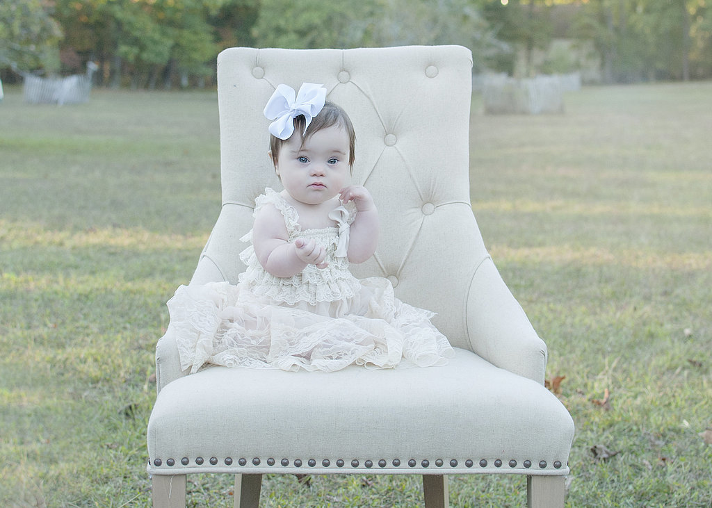 Szívszorító okból készült gyönyörű fotósorozat Down-szindrómás kisgyerekekről