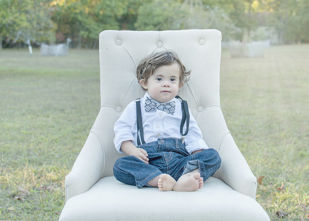Szívszorító okból készült gyönyörű fotósorozat Down-szindrómás kisgyerekekről