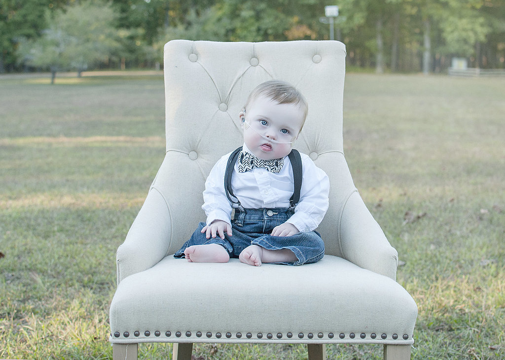 Szívszorító okból készült gyönyörű fotósorozat Down-szindrómás kisgyerekekről