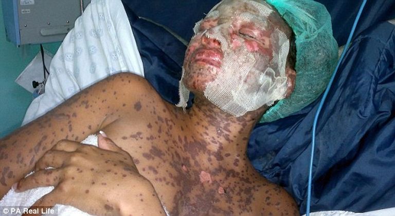 Nagyon rosszul járt az antidepresszánssal ez a nő Nagyon rosszul járt az antidepresszánssal ez a nő