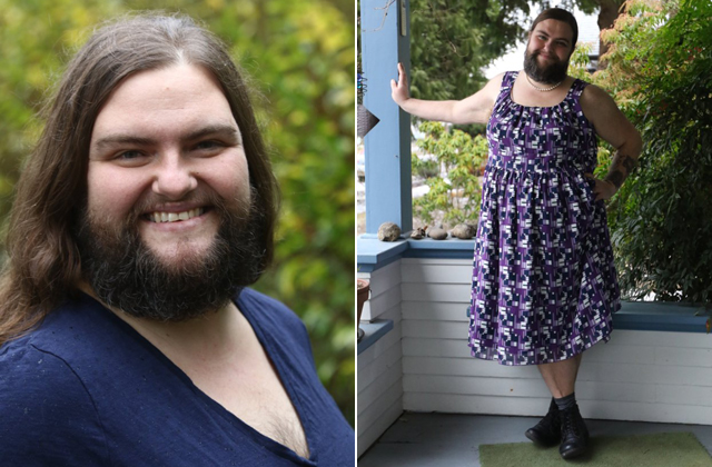 Abbahagyta a borotválkozást a nő, kinőtt a szakálla, most így néz ki - fotók