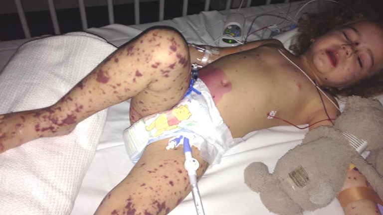 Csak apró horzsolásnak tűnt, pedig életveszélyes betegség jele volt Csak apró horzsolásnak tűnt, pedig életveszélyes betegség jele volt