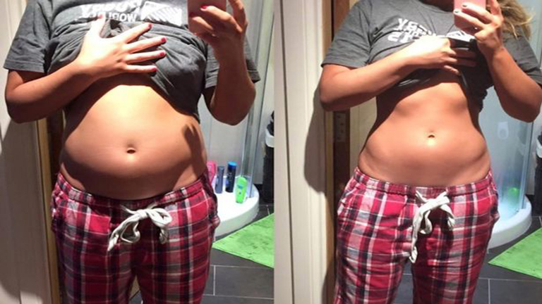 Teli hasát mutogatja a szépségkirálynő