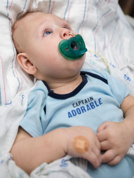 Úttörő műtéttel mentették meg a kisbabát, akinek a koponyáján kívül fejlődött az agya