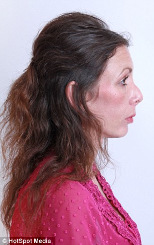 Orrműtétje miatt veszítette el állását és barátait