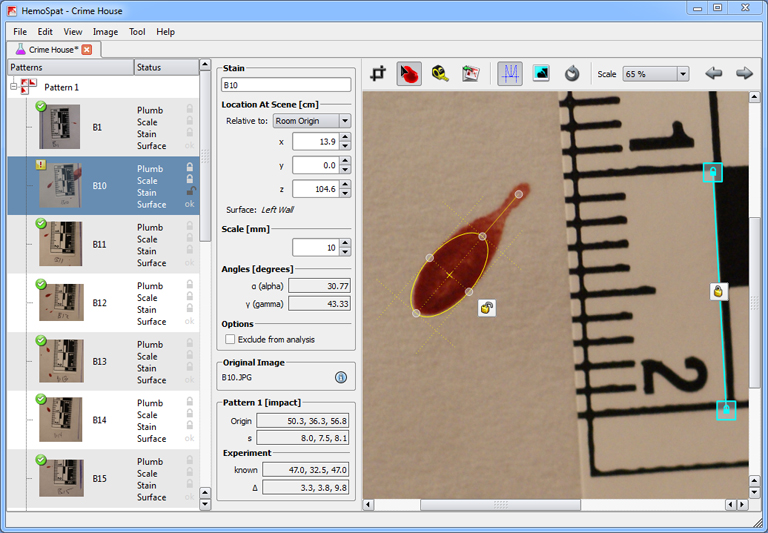 A HemoSpat vérnyomelemző szoftver kezelőfelülete (Fotó: HemoSpat.com)