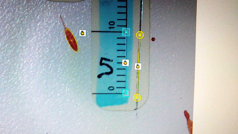 Vérnyom elemzése a HemoSpat szoftverben: a nyom pontos bejelölése után a számításokat már a gép végzi, ezzel rengeteg idő takarítható meg (Fotó: Dr. Petrétei Dávid/BSZKI)