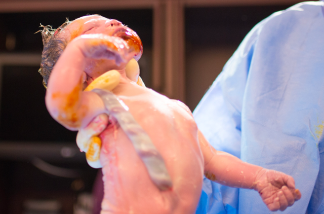 Egy anyuka, aki végig fotózta a saját vajúdását és szülését Egy anyuka, aki végig fotózta a saját vajúdását és szülését