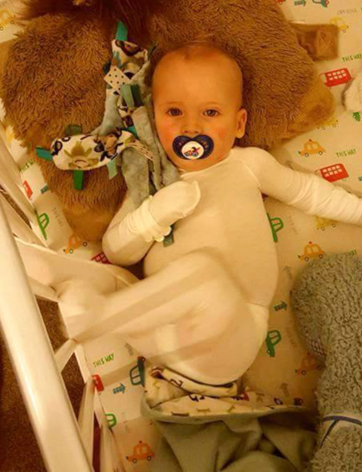 Súlyos bőrbetegsége miatt úgy néz ki a kisbaba, mintha állandóan vernék Súlyos bőrbetegsége miatt úgy néz ki a kisbaba, mintha állandóan vernék