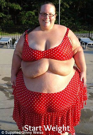 Megdöbbentő fogyás: két év alatt 160 kilótól szabadult meg Megdöbbentő fogyás: két év alatt 160 kilótól szabadult meg