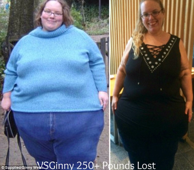 Megdöbbentő fogyás: két év alatt 160 kilótól szabadult meg Megdöbbentő fogyás: két év alatt 160 kilótól szabadult meg